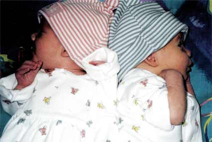 Twins-siamese