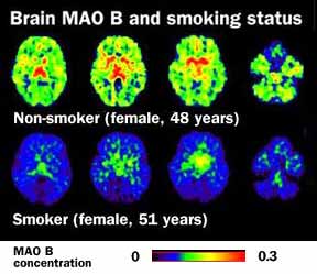 Comparison between smoker and non-smoker